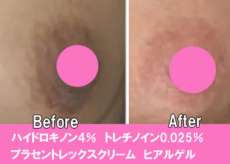 G-M-298 G-M-297 G-M-292 G-M-303