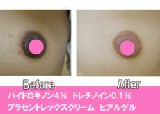 G-M-300 G-M-297 G-M-292 G-M-303